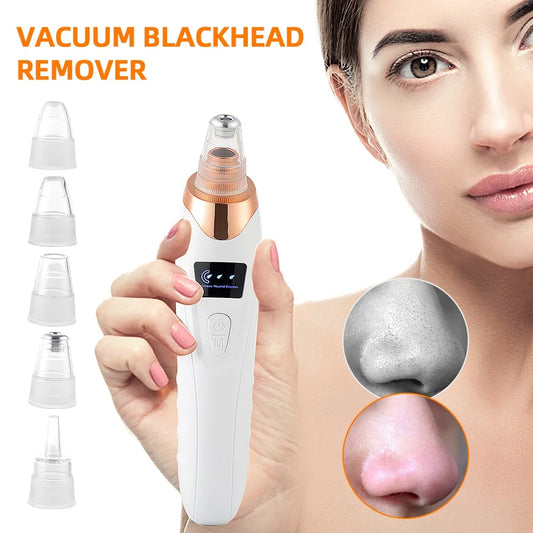 GT Precision Pore Vac