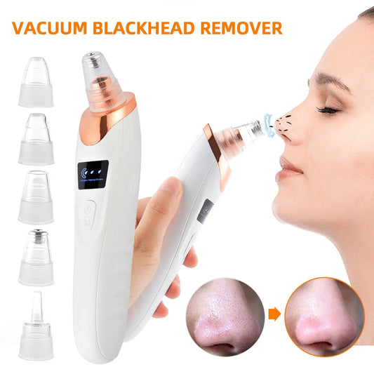 GT Precision Pore Vac